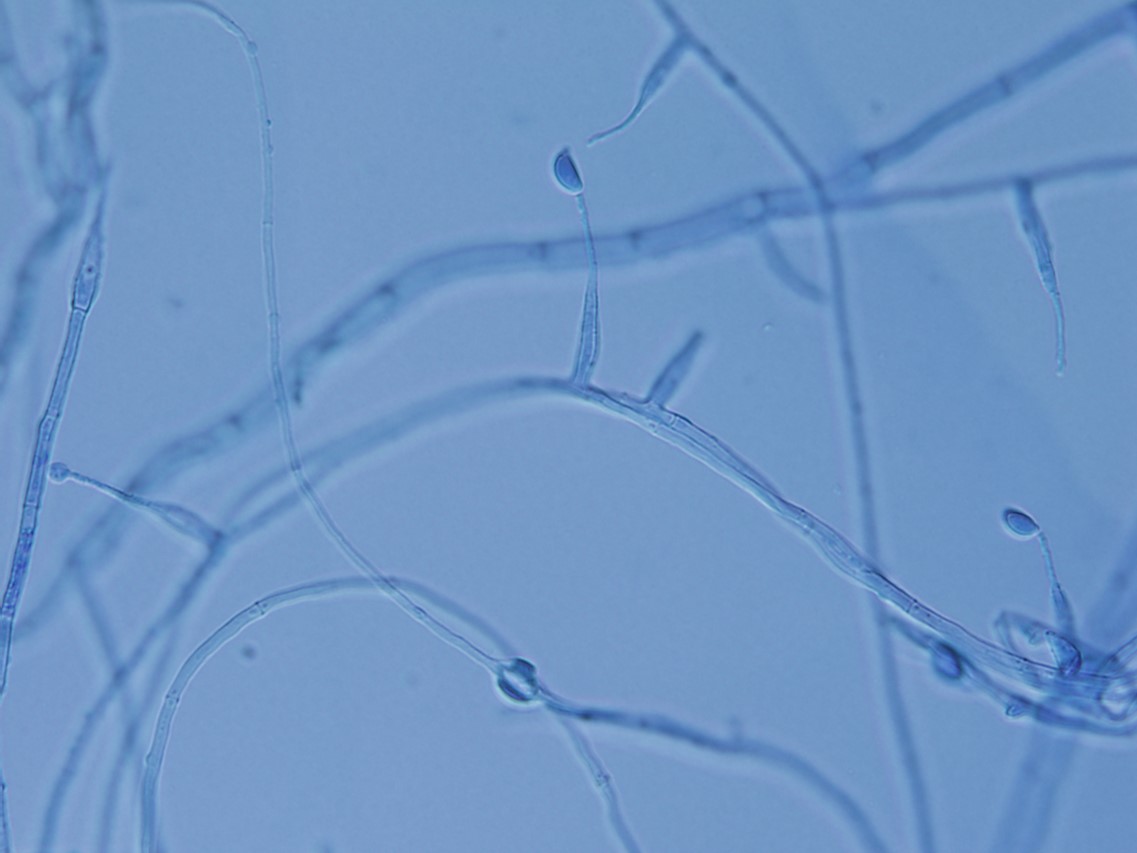 Ophiocordyceps campes